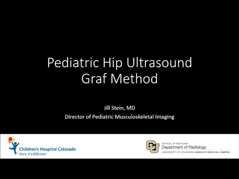 Hip Dysplasia Ultrasound - Pediatric US Multisite Conference May 2024