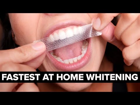 How to Whiten Your Teeth at Home (FAST + SAFE)