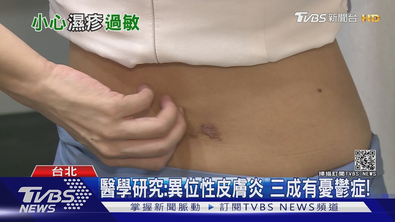 「染上這疾病」搔癢難耐 抓破皮!三成易罹「憂鬱症」