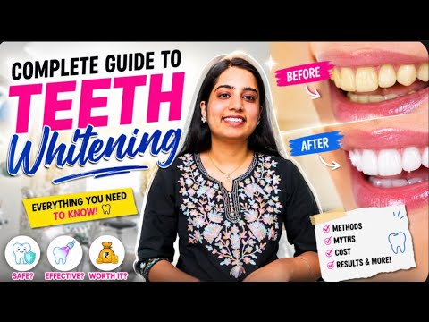 Teeth Whitening Explained: Does it really work? | Complete Guide