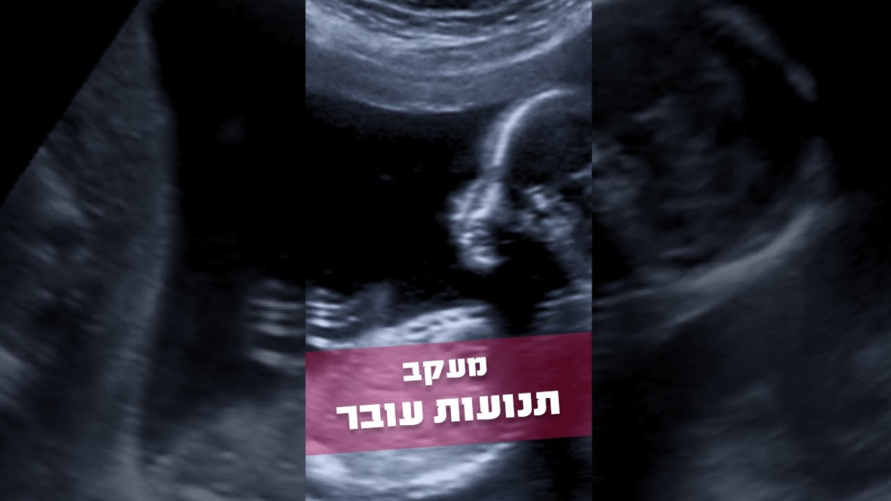סרטון טיפ: הרגשת את זה? איזה יופי - העובר זז! בואי לשמוע הכל על מעקב ...