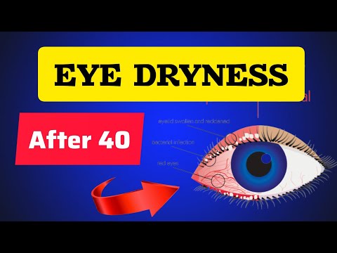Best Foods For Dry Eyes After 50