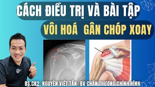 Cách điều trị và bài tập vôi hoá gân chóp xoay - Khớp Việt Official