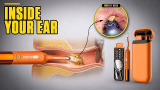 I Cleaned My Ear With a 4K Camera — Bebird EarSight Ultra X