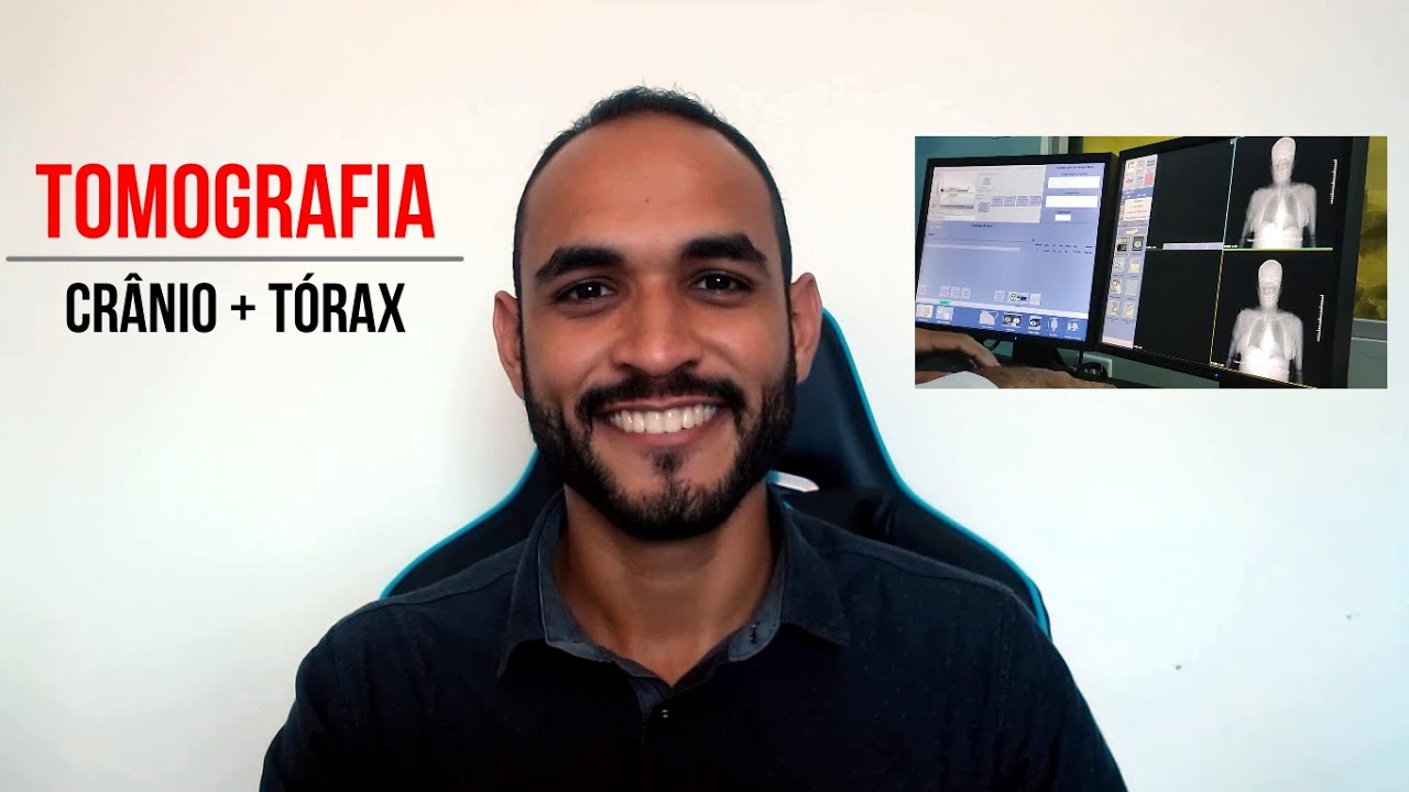 Tomografia - Crânio + Tórax