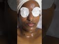 Going To Skinlab For Facial After An Year Check Out The Difference