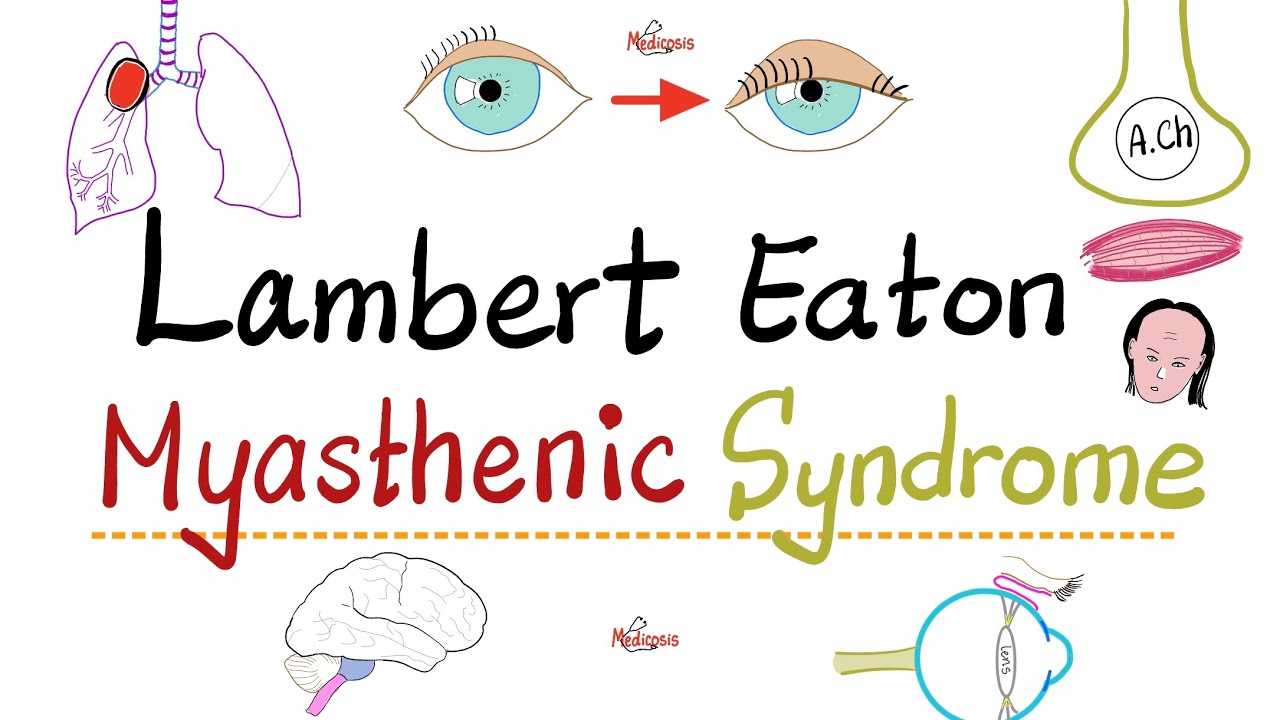 Lambert Eaton Myasthenic Syndrome (LEMS) - Muscle weakness - Causes, Symptoms, Diagnosis, Treatment