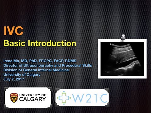 IVC - Basic Introduction