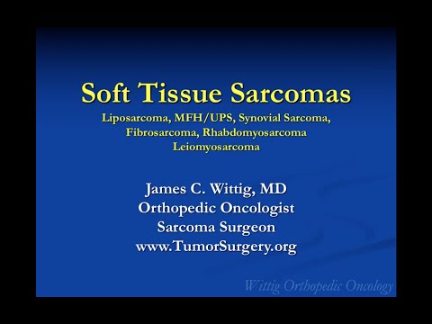 Orthopedic Oncology Course - Soft Tissue Sarcomas (Liposarcoma, MFH, etc.) - Lecture 10