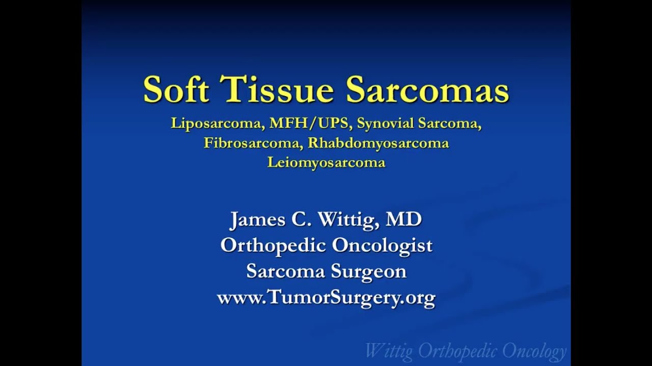 Orthopedic Oncology Course - Soft Tissue Sarcomas (Liposarcoma, MFH, etc.) - Lecture 10 - YouTube