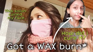 I got a wax burn on my face || how did I cure it? - storytime