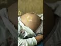 Periksa Bumil 9 Bulan Bumil Cantik