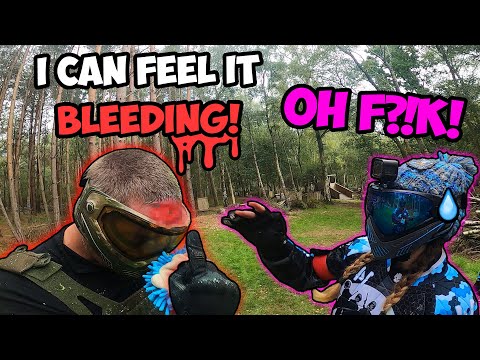 WTF HAPPENED TO HIS HEAD!🤕😱► Paintball Shenanigans (Part 108)