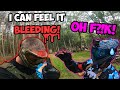 WTF HAPPENED TO HIS HEAD Paintball Shenanigans Part 108