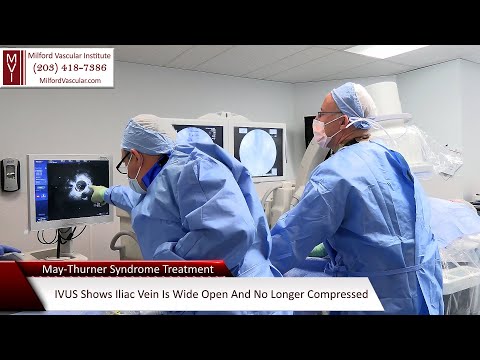 MayThurner Syndrome Treatment New Haven CT By The Best Vascular Surgeon Serving Milford, Bridgeport