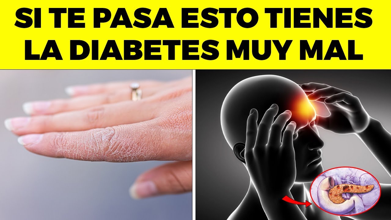 SI Sientes Esto "RARO" TU DIABETES YA ESTA MORTAL
