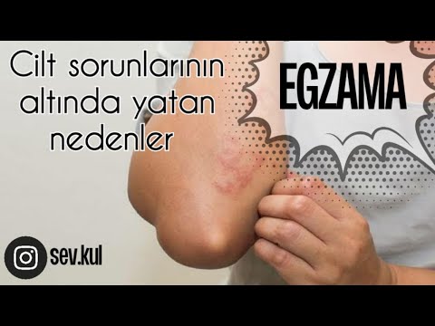 vörös foltok a lábakon és a csípőn