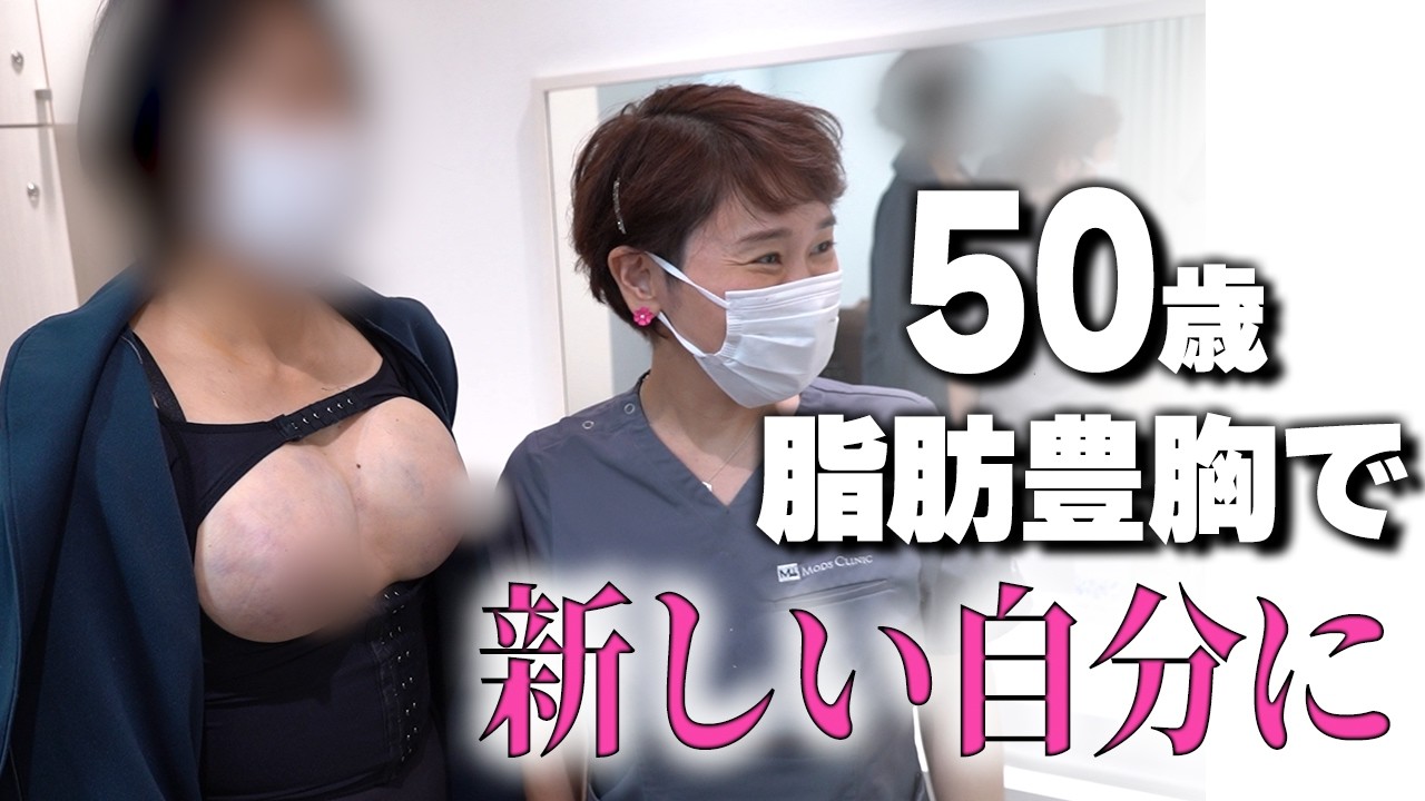 プロレスラーと呼ばれた上半身！胸は大きく華奢になる！50歳、脂肪豊胸で新しい自分に！