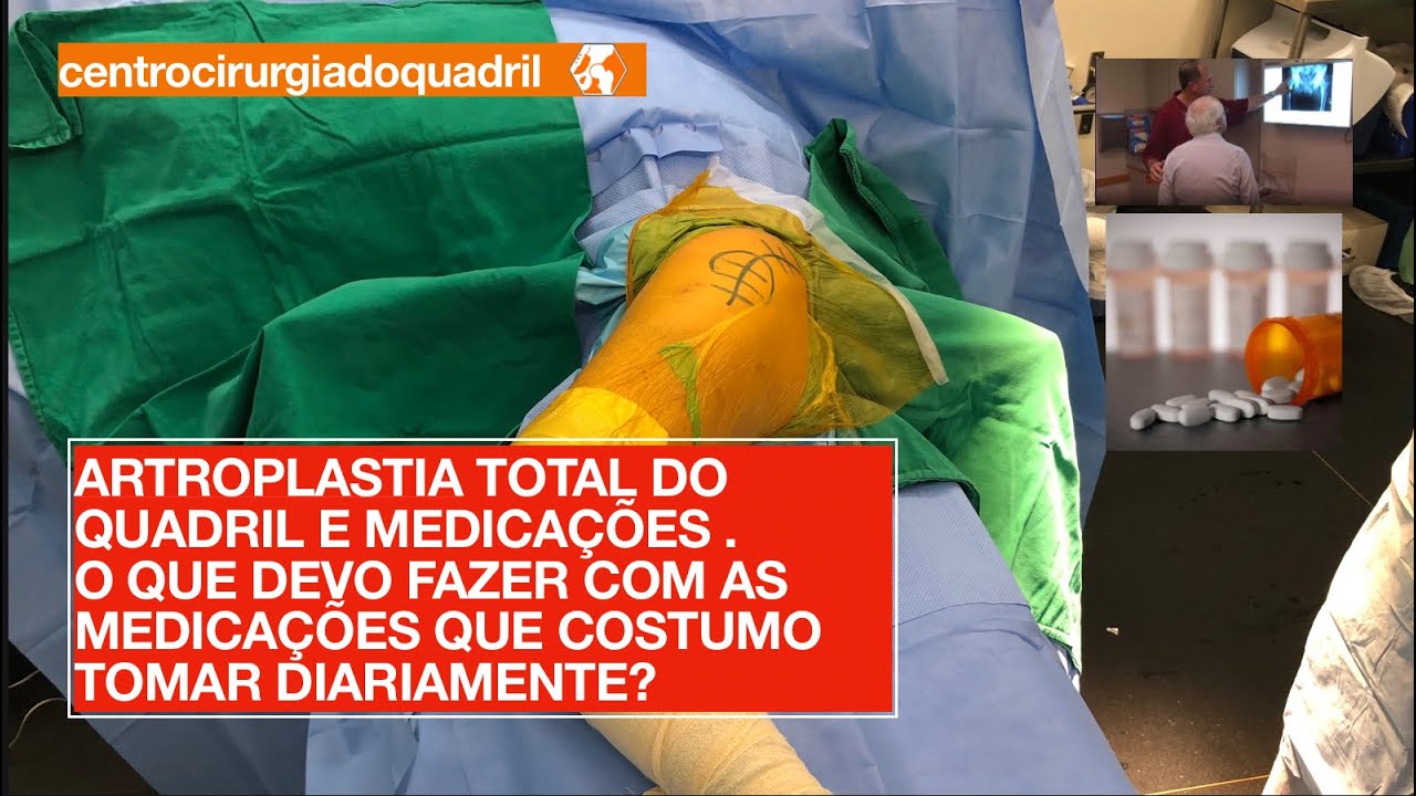 Marcus Vinicius Crestani-10