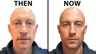Doctor Gary Linkov's NEW FACE | Plastic Surgery Analysis