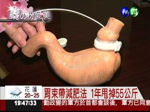 甩肉大絕招! 胃束帶1年瘦55公斤