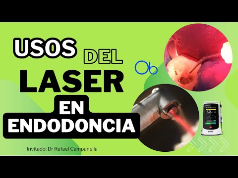 Usos del laser en Endodoncia