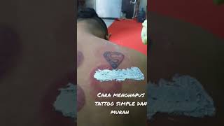 Download lagu Cara menghapus Tattoo simple dan murah, mp3