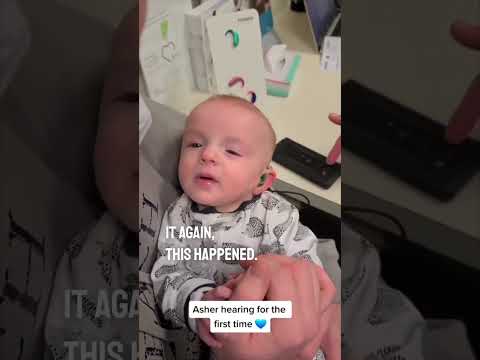 Baby gets hearing aids to hear for the first time ❤️