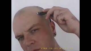 Gut Health – “Separate States”