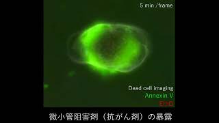 New micro-platform reveals cancer cells' natural behavior