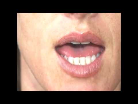 🔉 Helpful Video with Accent Drills: [ɛ] vs [æ]