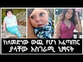 ከለመድነው ውጪ የሆነ አፈጣጠር ያላቸው አስገራሚ ህፃናት Un Usu