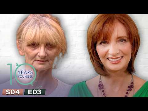 Ultimate Anti Aging | 10 Years Younger UK Season 4 Episode 3
