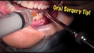 What Is An Oral Surgery Assistant? Oral Surgery Assistant Overview - Zippia