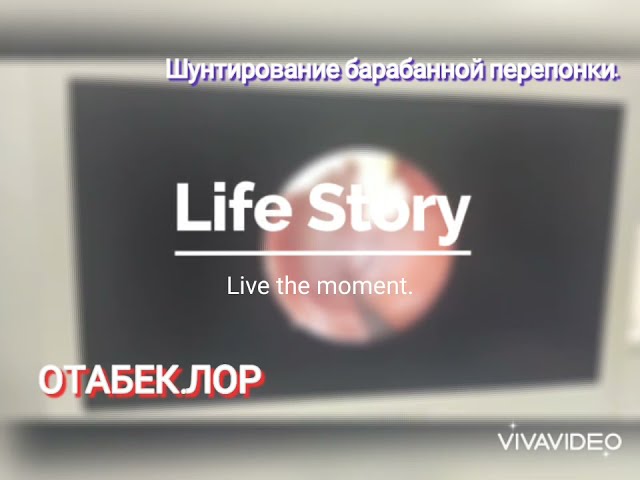 Операция по удалению аденоида Шунтирование барабанной перепонки в Ташкенте