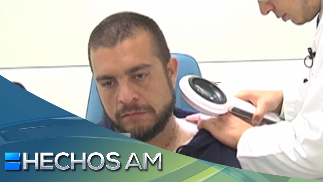 Watch Consultorio AM | Cap 50 | Eliminación de verrugas Now Consultorio AM | Cap 50 | Eliminación de verrugas