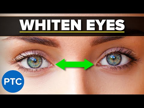 Remove Braces in Photoshop Easy Pro Level Results