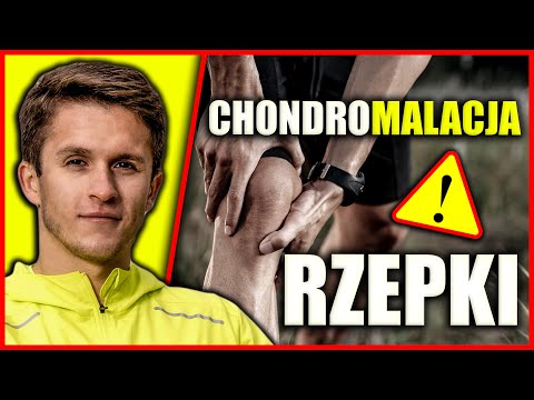 Chondromalacja Rzepki - Ćwiczenia - Ból Kolana - Rzepka - Bieganie