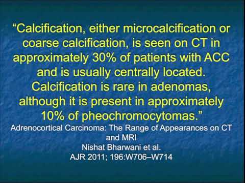 CT Evaluation of Primary Adrenocortical Carcinoma Part 1