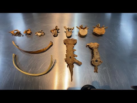 Vertebral Column, Ribs and Sternum - Axial Skeleton