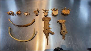 Coluna Vertebral, Costelas e Esterno - Esqueleto Axial