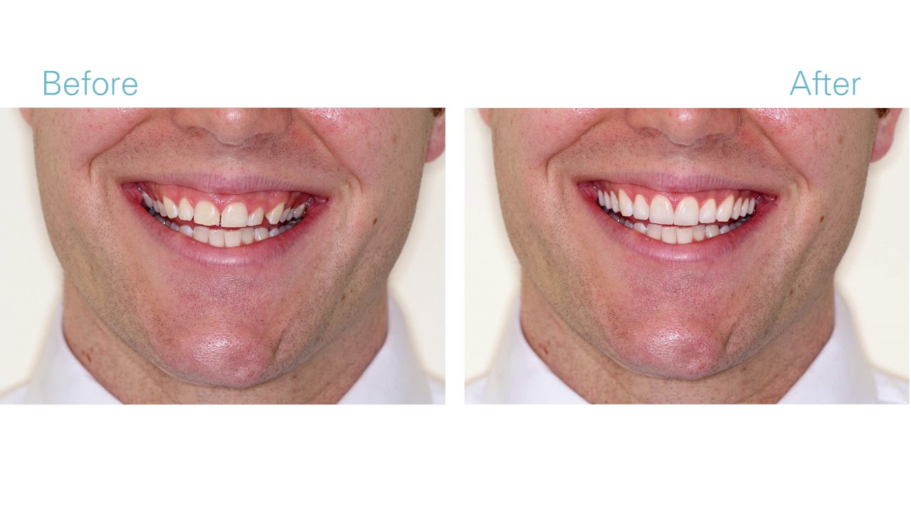 Cosmetic Dentistry NYC - Video