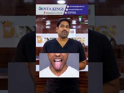 வாய் கசப்பு எதனால் வருகிறது? Why bitter taste after fever? In Tamil | Denta Kings |  Dr.Karthikeyan