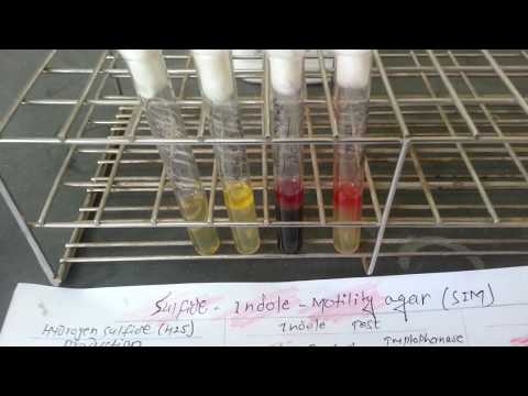 SIM test: principle, procedure, result interpretation and limitations