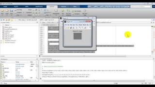 Alzheimer’s disease using matlab code