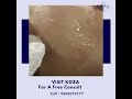 𝗖𝗼𝗰𝗸𝘁𝗮𝗶𝗹 𝗦𝗸𝗶𝗻 𝗜𝗻𝗳𝘂𝘀𝗶𝗼𝗻 𝗧𝗿𝗲𝗮𝘁𝗺𝗲𝗻𝘁. #koza #kozaaestheticcare #kozabangalore #skincare #skin