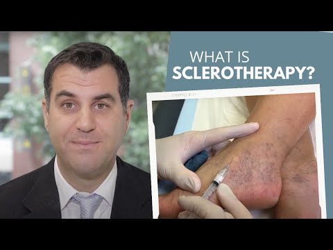 What is Sclerotherapy treatment for Varicose Veins? | Vein Health Clinic
