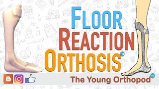 Floor Reaction Orthosis (FRO)