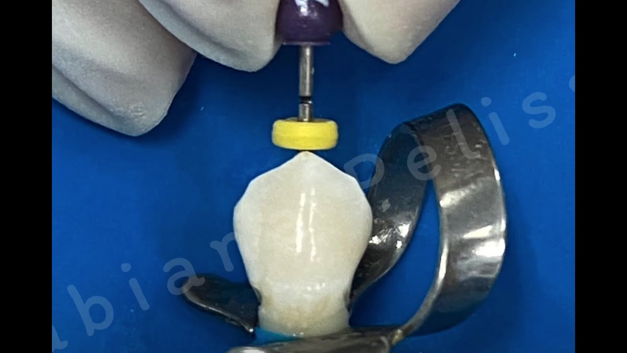 Esvaziamento do canal em necrose pulpar - Penetração desinfetante - Profa. Fabiana Vier Pelisser