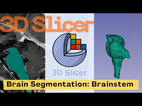 🧠Brain Segmentation with 3D Slicer: Brainstem